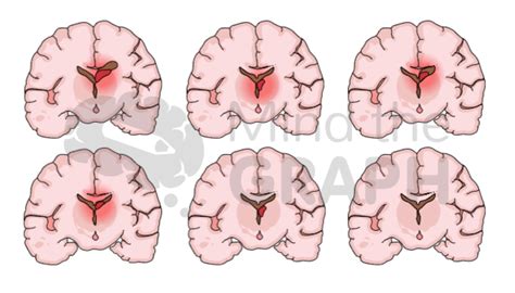 Mind The Graph Blog 27 Pediatrics Illustrations And More The Best