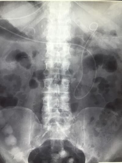 The spine is divided into several sections. What is a Pelvis or Pelvic Xray? | Two Views
