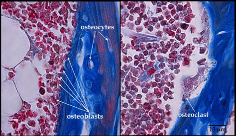 Osteoclast Histology