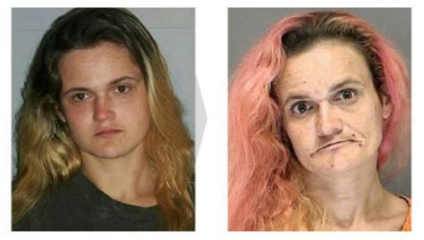 18 Disturbing Before And After Pictures Of Faces Transformed By Drug