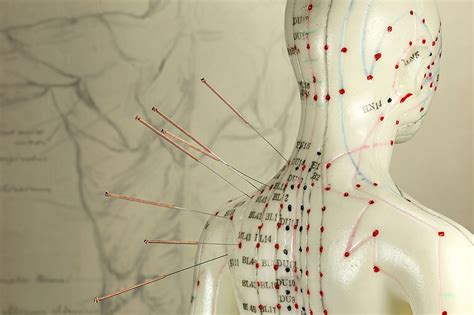 The Many Benefits Of Acupuncture Repair Restore Regenerate
