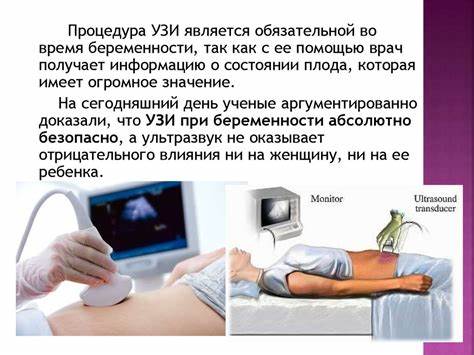 Беременность. 1 триместр - презентация онлайн Картинка - Беременность. 1 триместр - презентация онлайн