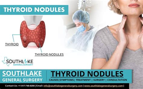 Thyroid Nodules Symptoms Treatment And Surgery Southlake General