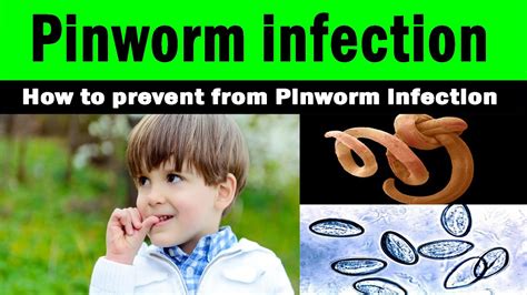Pinworm Infection How To Prevent From Pinworm Infection Home