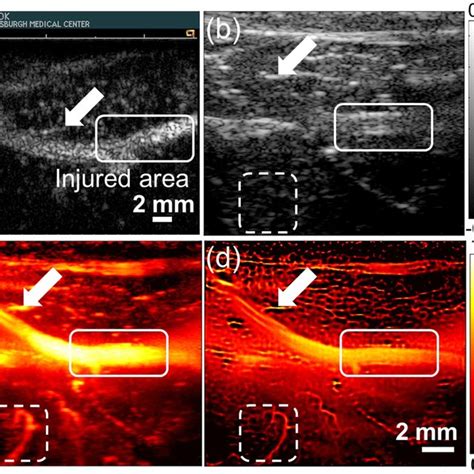 Pdf Super Resolution Ultrasound Imaging Method For Microvasculature