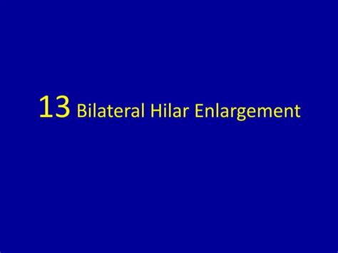 13 Bilateral Hilar Enlargement Ppt