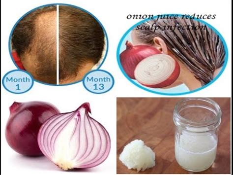 Rubbing the onions or massaging the juice into the scalp will help reverse the process of hair greying by neutralizing hydrogen peroxide. How to use onion juice for hair regrowth and to stop hair ...