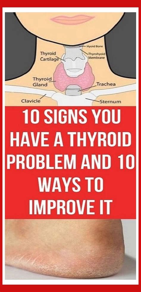 10 Warning Signs You Have Thyroid Problems
