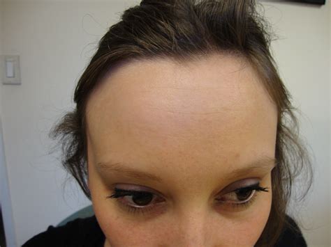 file human forehead wikimedia commons