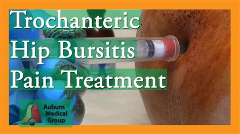 Physical therapy is an integral component in the management of hip pain. Trochanteric Hip Bursitis Pain Treatment | Auburn Medic ...