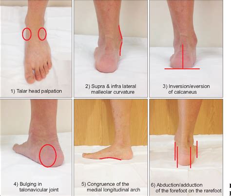 Foot Posture Index Score Sheet