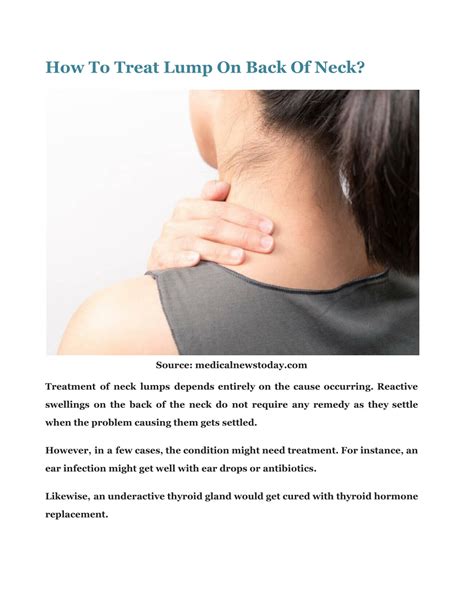 Ppt What Causes A Lump On Back Of Neck And What To Do About It Powerpoint Presentation Id11499949