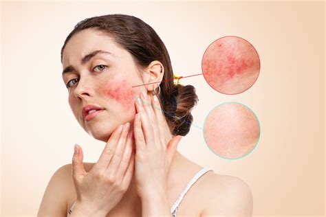 Expert Wellness Health Skin Care Tips And Insights Skin111