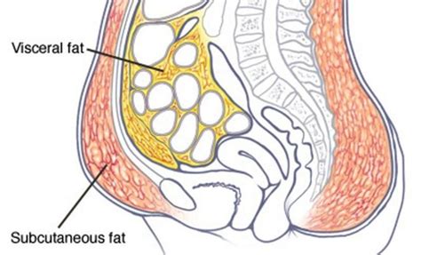 The Different Types Of Tummy Fat And How To Lose It For Good