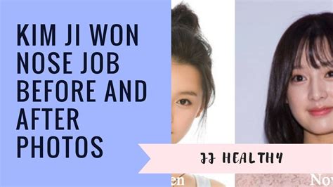 Kim Ji Won Nose Job Before And After Photos Youtube
