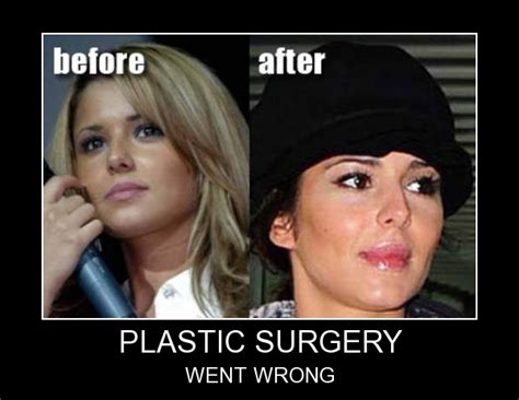 Best ★plastic surgery quotes★ at quotes.as. Funny Surgeon Quotes. QuotesGram