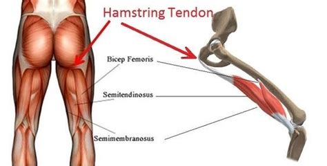 Each part gives rise to a tendon which contains a sesamoid bone near its insertion. Proximal hamstring tendinopathy - Physiotherapy Manly