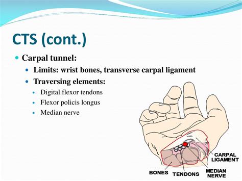 Ppt Work Related Upper Extremity Musculoskeletal Diseases Powerpoint