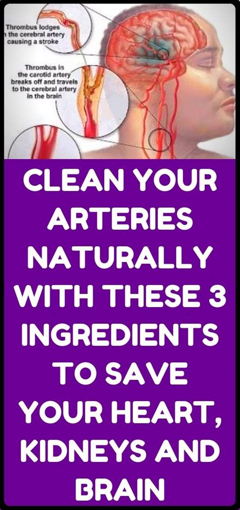 clean out plaque and unclog your arteries 3 ingredients mixture