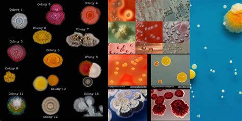 Identifying Bacteria