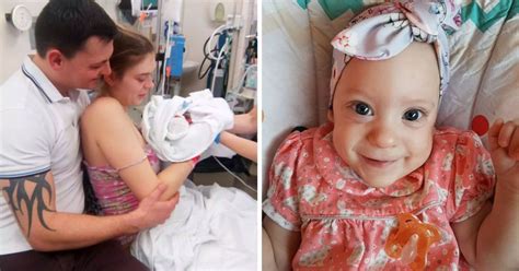 Baby Born With Underdeveloped Brain Defies The Odds By Celebrating First Birthday