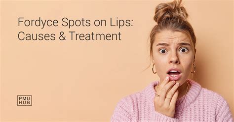What Are Fordyce Spots On Lips Causes And Treatment