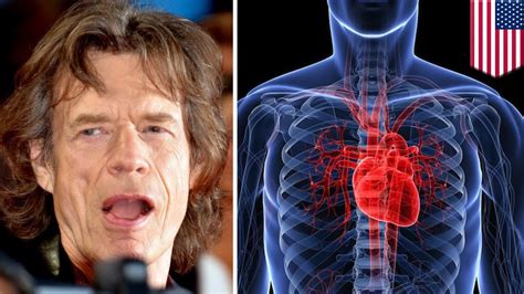 Mick Jagger Heart Surgery Mick Jagger Is Feeling Much Better Now