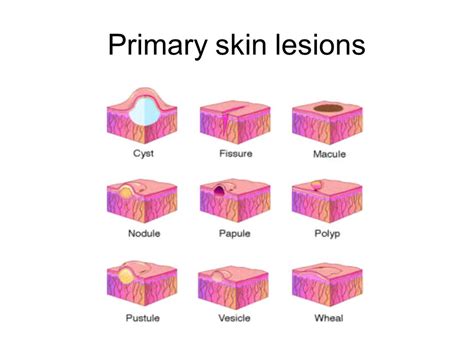 Study Medical Photos Description Of Primary Skin Lesions