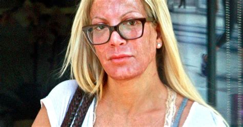 Tori spelling blames the press for april fools' pregnancy joke. Tori Spelling Leaves Spa With Inflamed, Red Face: What ...