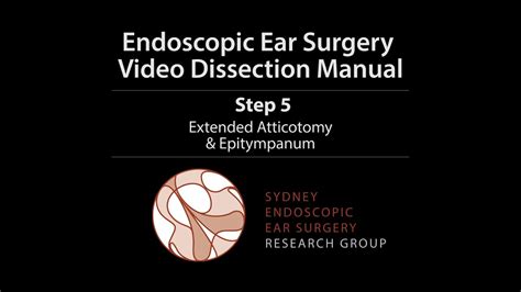 Step 5 Sydney Endoscopic Ear Surgery Video Dissection Manual Youtube