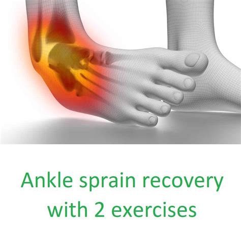 Sprained Ankle Treatment With 2 Exercises Grade 1 2 Or 3