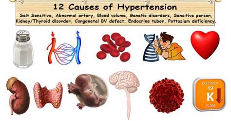 12 Hypertension Causes 5 Primary And 7 Secondary High Pressure Causes