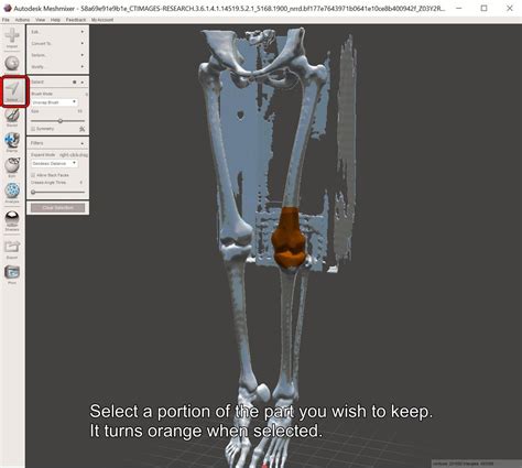 how to easily and automatically convert a ct scan dicom data into a 3d printable medical model