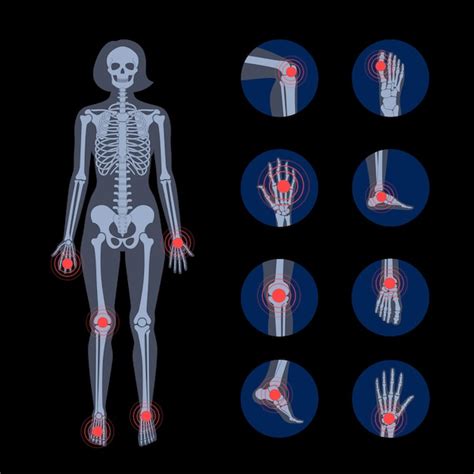Premium Vector Pain In Human Body Female Skeleton Silhouette