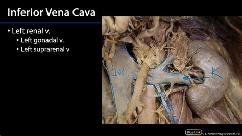 Inferior Vena Cava Duodenum Pancreas And Abdominal Aorta Sdv Youtube