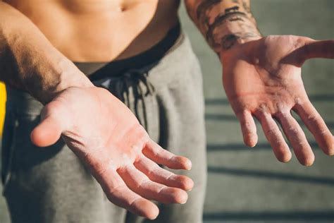 Tips On How To Prevent Calluses From Lifting