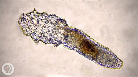 These Face Mites Really Grow On You Kqed