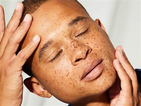 What To Know About Freckles And How To Fake The Look