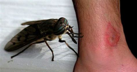 Here Are Common Bug Bites And How You Can Recognize Them