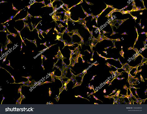Real Fluorescence Microscopic View Human Skin Stock Photo 1366688945