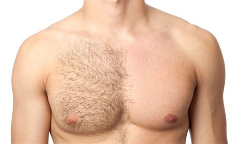 Pros And Cons Of Mens Laser Hair Removal Spoiled Laser