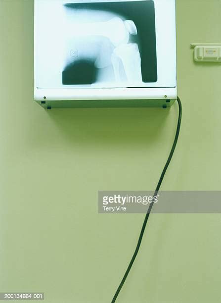 X Ray Wall Photos And Premium High Res Pictures Getty Images