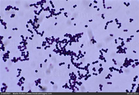 Stock Image Photomicrograph Of Group A Beta Hemolytic Streptococcus