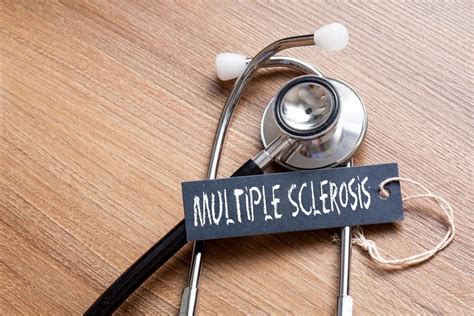 Multiple Sclerosis Advances In Research And