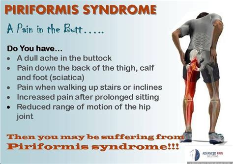 Pin On Piriformis Syndrome