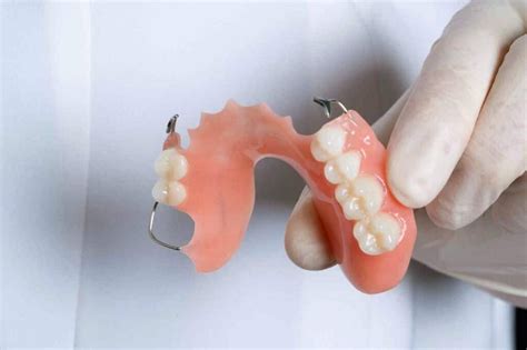 partial dentures in los algodones dental solutions