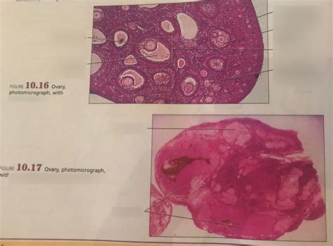 Female Reproductive System Page 174 Ovary Photomicrographs With Ovarian Follicles Pic 1