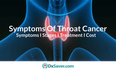 Symptoms Of Throat Cancer More About Early Signs Causes Stages And Treatment