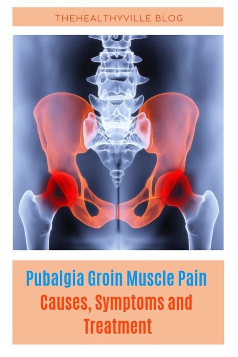Groin Pain In Athletes Symptoms Causes Treatment