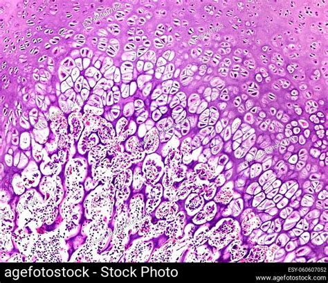 Epiphyseal Secondary Ossification Stock Photos And Images Agefotostock